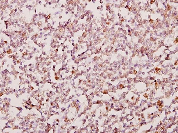 a06642 psmd2 primary antiboties ihc testing 2