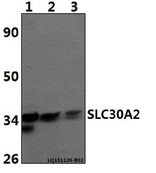 Western blot (WB) analysis of SLC30A2 polyclonal antibody at 1:500 dilution
Lane1:PC12 whole cell lysate(40ug)
Lane2:Hela whole cell lysat(40ug)
Lane3:RAW264
