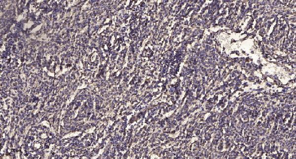 a06645 tlk2 primary antibodies ihc testing 1