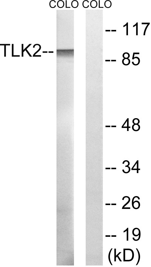 a06645 tlk2 primary antibodies wb testing 3