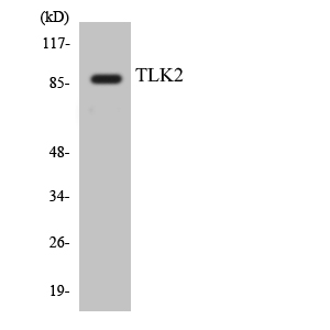 a06645 tlk2 primary antibodies wb testing 4