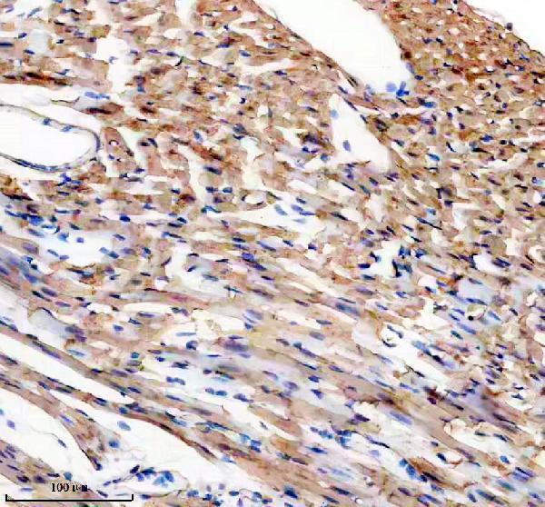 IHC analysis of NEXN using anti-NEXN antibody (A06648-1)