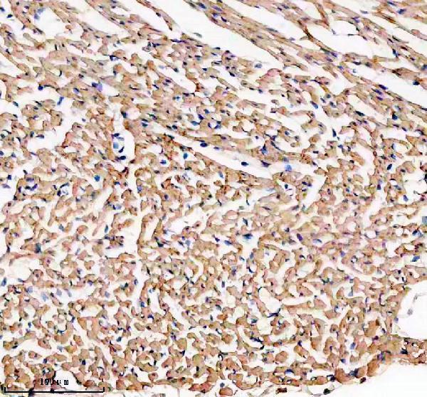 IHC analysis of NEXN using anti-NEXN antibody (A06648-1)