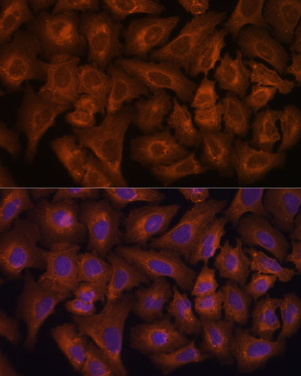 Immunofluorescence analysis of U-2 OS cells using NEXN antibody  at dilution of 1:100
