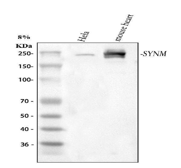  Western blot analysis of SYNM using anti-SYNM antibody (A06653-1)