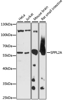 a06654 sppl2a primary antiboties wb testing 1