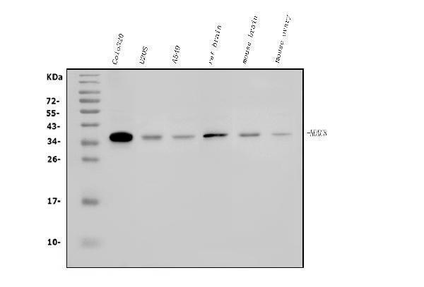  Western blot analysis of HOXC8 using anti-HOXC8 antibody (A06655-1)