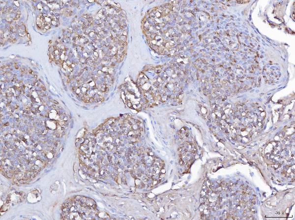  IHC analysis of Pleckstrin/PLEK using anti-Pleckstrin/PLEK antibody (A06656-3)