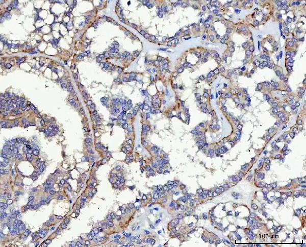  IHC analysis of SLC17A5 using anti-SLC17A5 antibody (A06657-2)