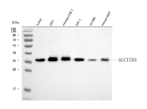  Western blot analysis of SLC17A5 using anti-SLC17A5 antibody (A06657-2)