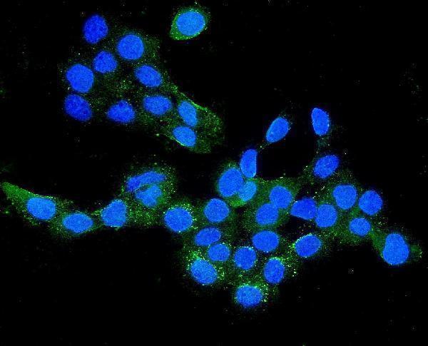 a06659 1 cldn16 primary antibodies if testing 2