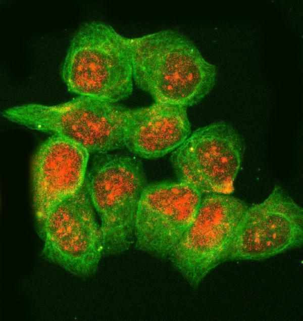 a06660 1 rnaseh2b primary antibodies if testing 2