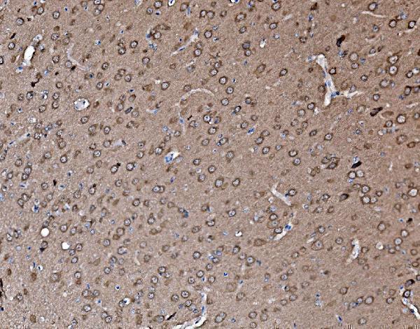 a06663 pfn2 primary antibodies ihc testing 2