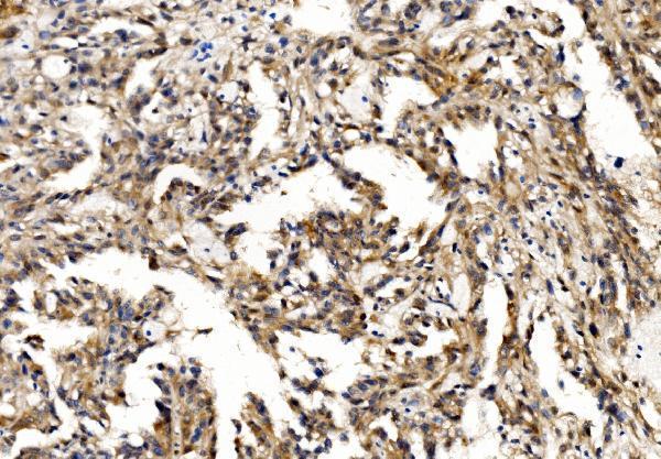 a06663 pfn2 primary antibodies ihc testing 3