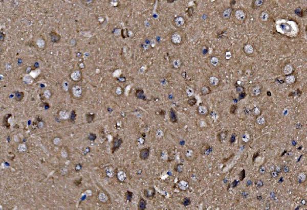 a06663 pfn2 primary antibodies ihc testing 4