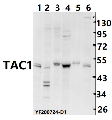 a06666 1 tac1 primary antiboties wb testing 1
