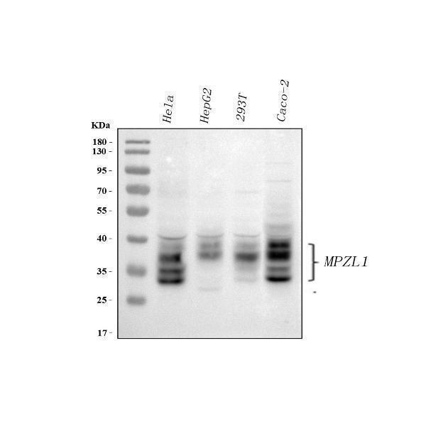  Western blot analysis of MPZL1 using anti-MPZL1 antibody (A06667-1)