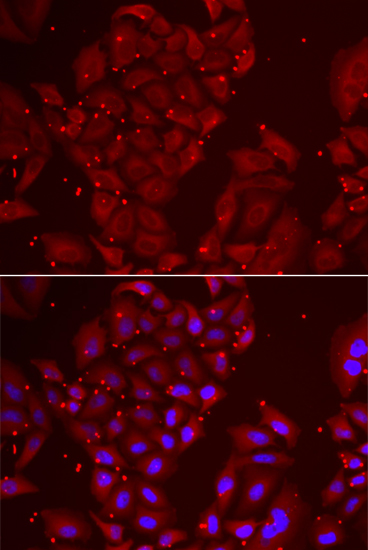 Immunofluorescence analysis of U2OS cells using TPP2 antibody 