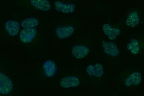 a06668 2 tpp2 primary antibodies if testing 6