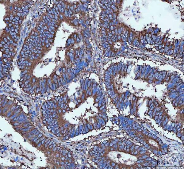  IHC analysis of Tripeptidyl peptidase II/TPPII/TPP2 using anti-Tripeptidyl peptidase II/TPPII/TPP2 antibody (A06668-2)