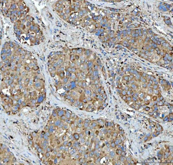 a06668 2 tpp2 primary antibodies ihc testing 4