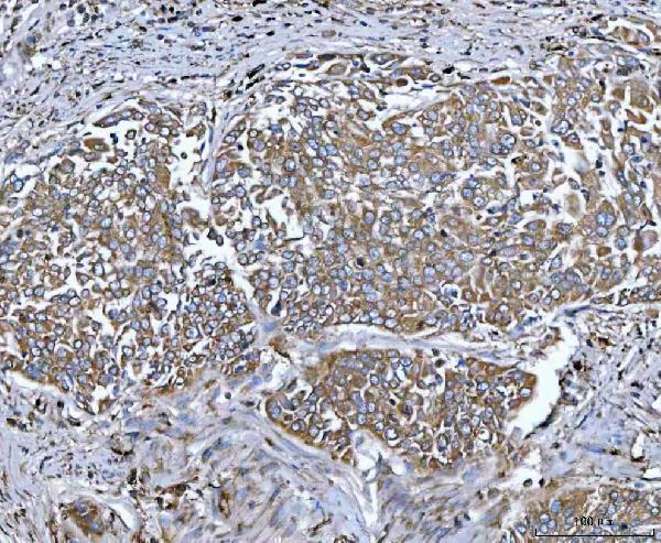 a06668 2 tpp2 primary antibodies ihc testing 5