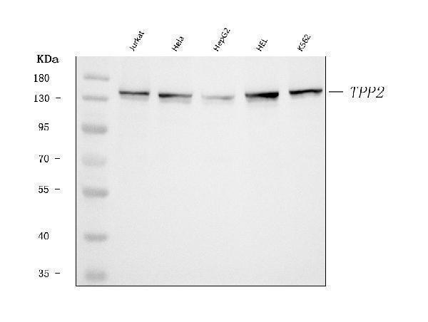  Western blot analysis of Tripeptidyl peptidase II/TPPII/TPP2 using anti-Tripeptidyl peptidase II/TPPII/TPP2 antibody (A06668-2)
