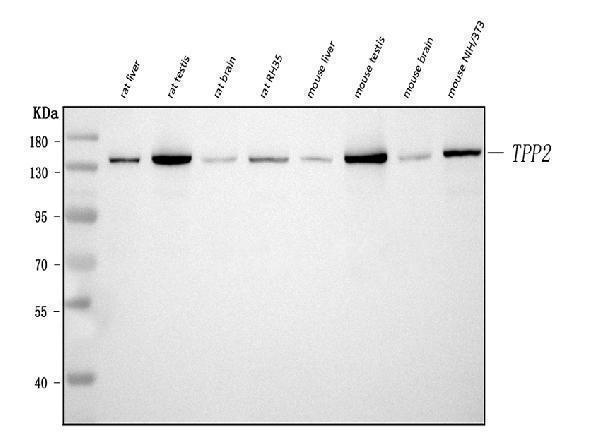  Western blot analysis of Tripeptidyl peptidase II/TPPII/TPP2 using anti-Tripeptidyl peptidase II/TPPII/TPP2 antibody (A06668-2)