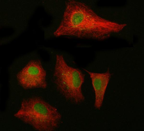  IF analysis of NAB1 using anti-NAB1 antibody (A06669-1) and anti-Beta Tubulin antibody (M01857-3)