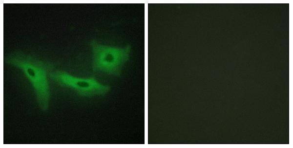 a06670 lrrk1 primary antibodies if testing 1