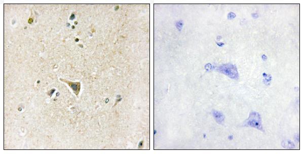 a06670 lrrk1 primary antibodies ihc testing 2