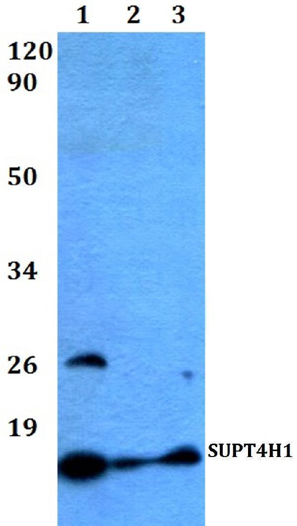 a06673 supt4h1 primary antiboties wb testing 1