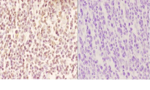 a06675 1 mnda primary antiboties ihc testing 2