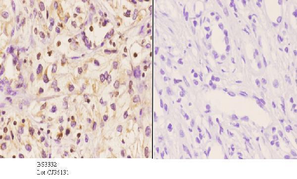 a06675 1 mnda primary antiboties ihc testing 3