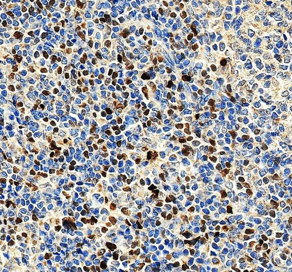 a06675 2 mnda primary antibodies ihc testing 2