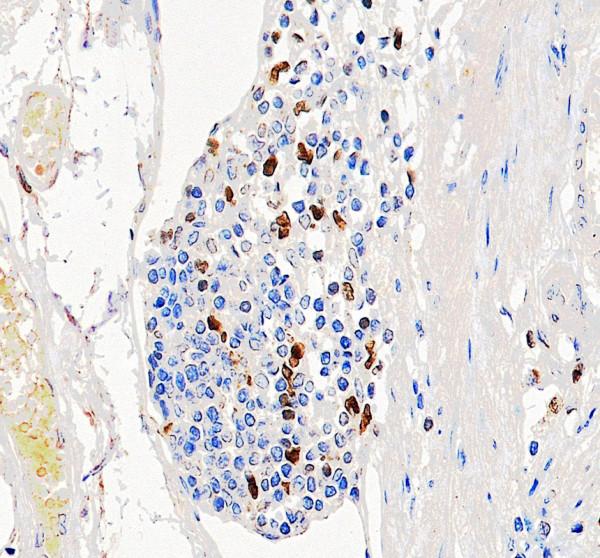 a06675 2 mnda primary antibodies ihc testing 3