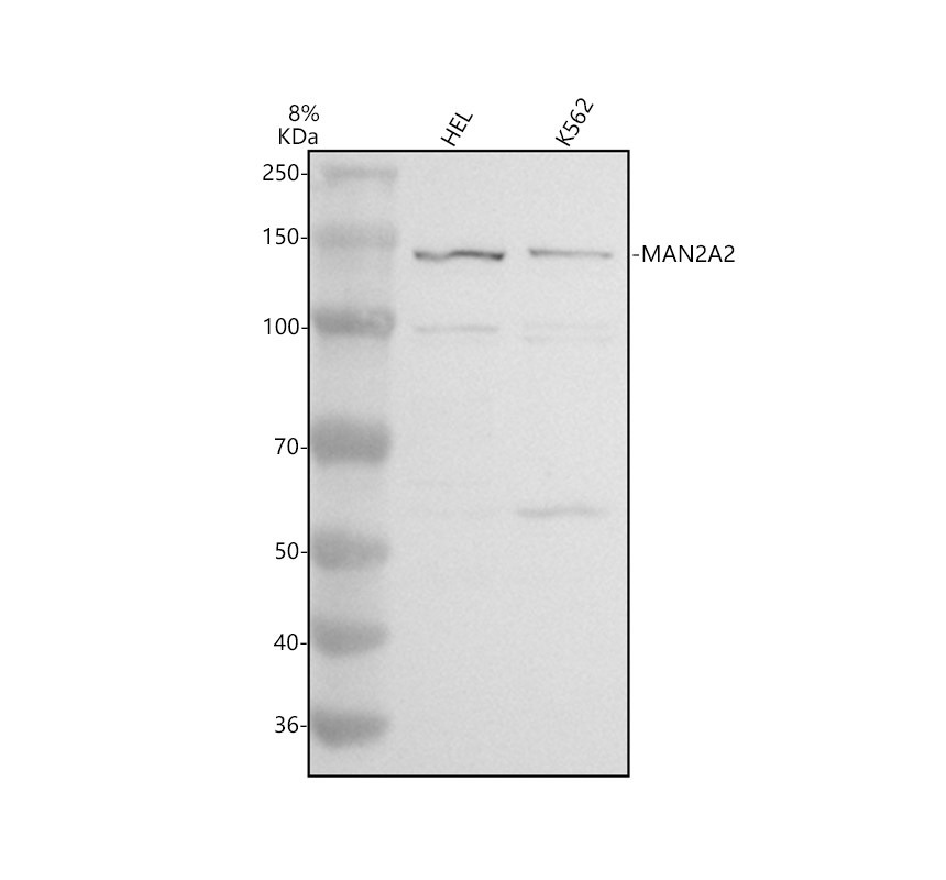 Western blot analysis of MAN2A2 using anti-MAN2A2 antibody (A06677-1)