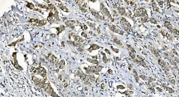 a06678 2 dgkz primary antibodies ihc testing 3