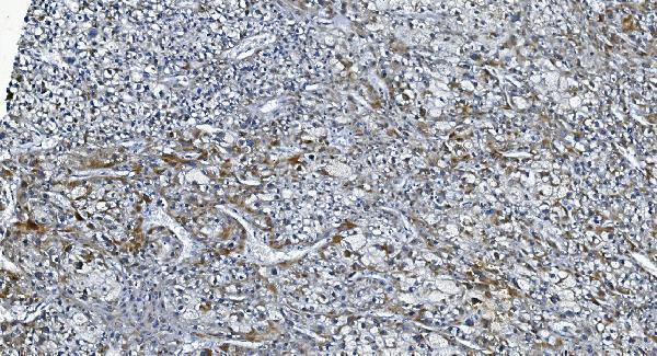 a06678 2 dgkz primary antibodies ihc testing 4