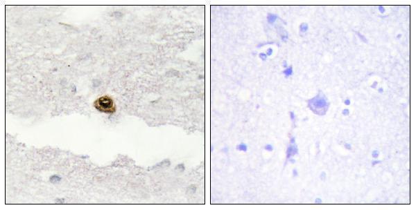 a06678 dgkz primary antibodies ihc testing 1