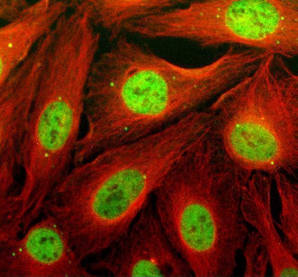 IF analysis of TCF20 using anti-TCF20 antibody (A06679-1) and anti-Beta Tubulin antibody (M01857-3)