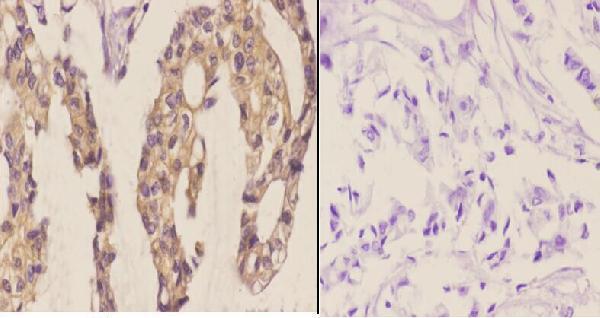 a06680 1 fzd8 primary antiboties ihc testing 2