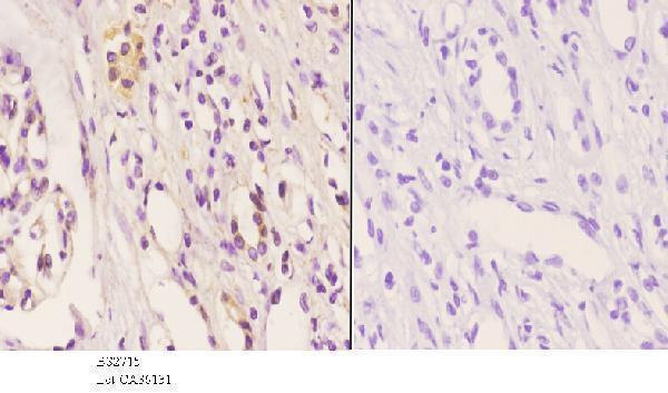 a06680 1 fzd8 primary antiboties ihc testing 3