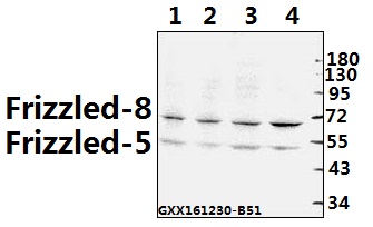 a06680 1 fzd8 primary antiboties wb testing 1
