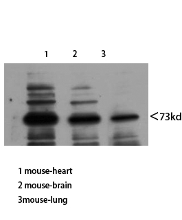 Western Blot analysis of mouse-heart mouse-brain mouse-lung using Neuregulin-3 Polyclonal Antibody diluted at 1:800