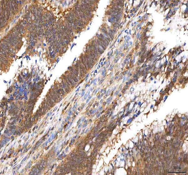 a06683 1 pdxk primary antibodies ihc testing 4