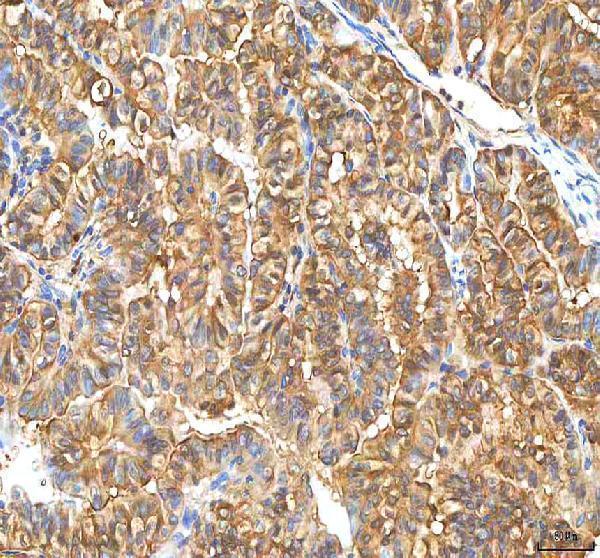 a06683 1 pdxk primary antibodies ihc testing 6