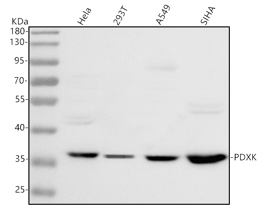  Western blot analysis of PDXK using anti-PDXK antibody (A06683-1)
