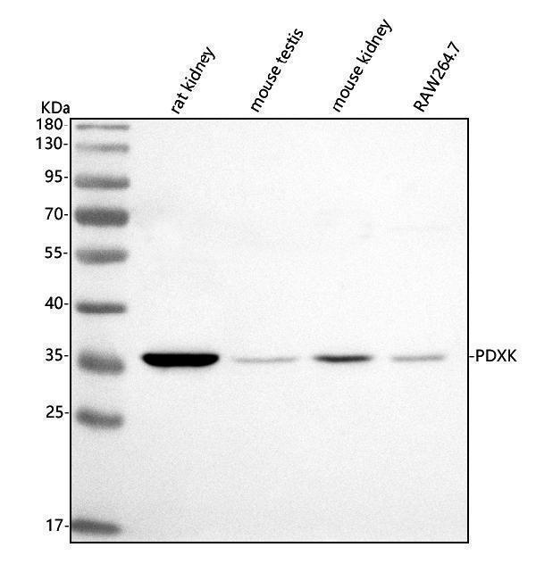 Western blot analysis of PDXK using anti-PDXK antibody (A06683-1)