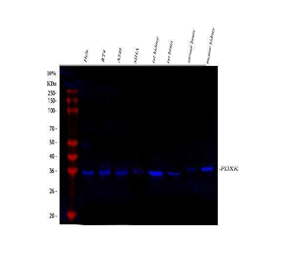  Western blot analysis of PDXK using anti-PDXK antibody (A06683-1)